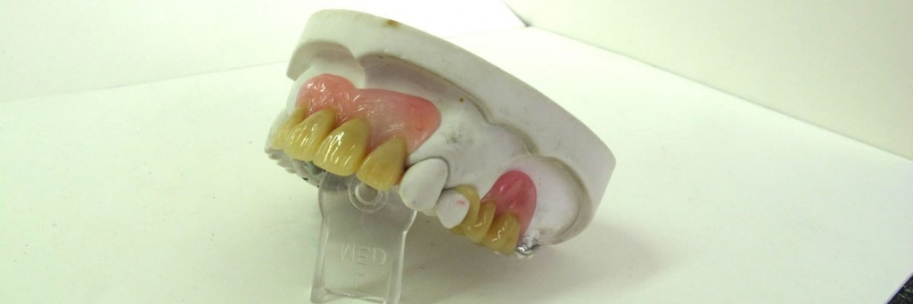 Acrylic Dentures Jeremiah KY 41826